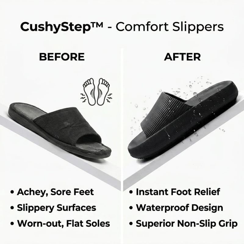 TIJDELIJK 50% KORTING | CushyStep™ - Comfort Pantoffels