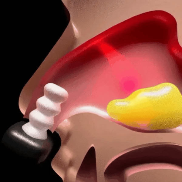 TIJDELIJK 50% KORTING  LumaBreathe™