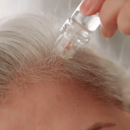TIJDELIJK 50% KORTING  Capilia™ - Regenererende haar-micro-infusie