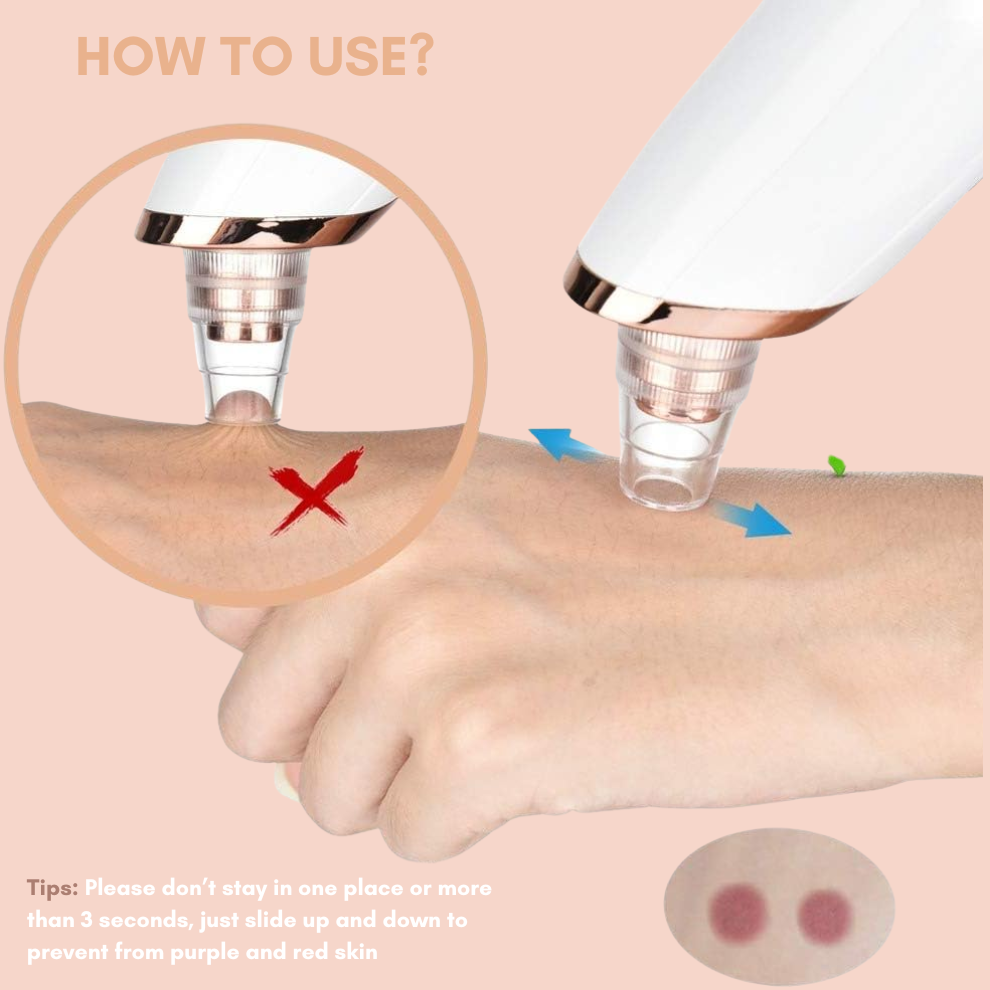 TIJDELIJK 50% KORTING | DermaVeo™