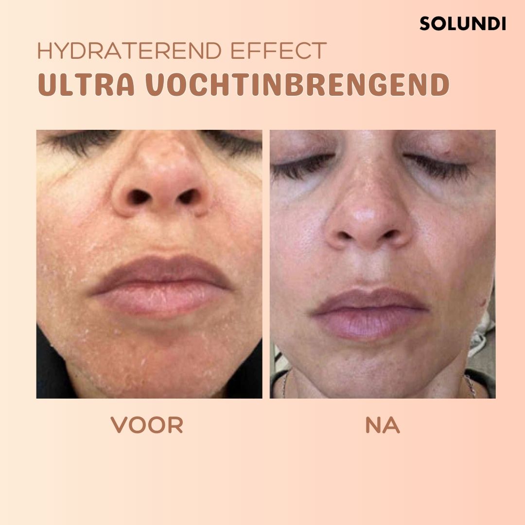 TIJDELIJK 1+1 GRATIS | MultiBalm™ - Anti-rimpel huidvernieuwingsbalsem