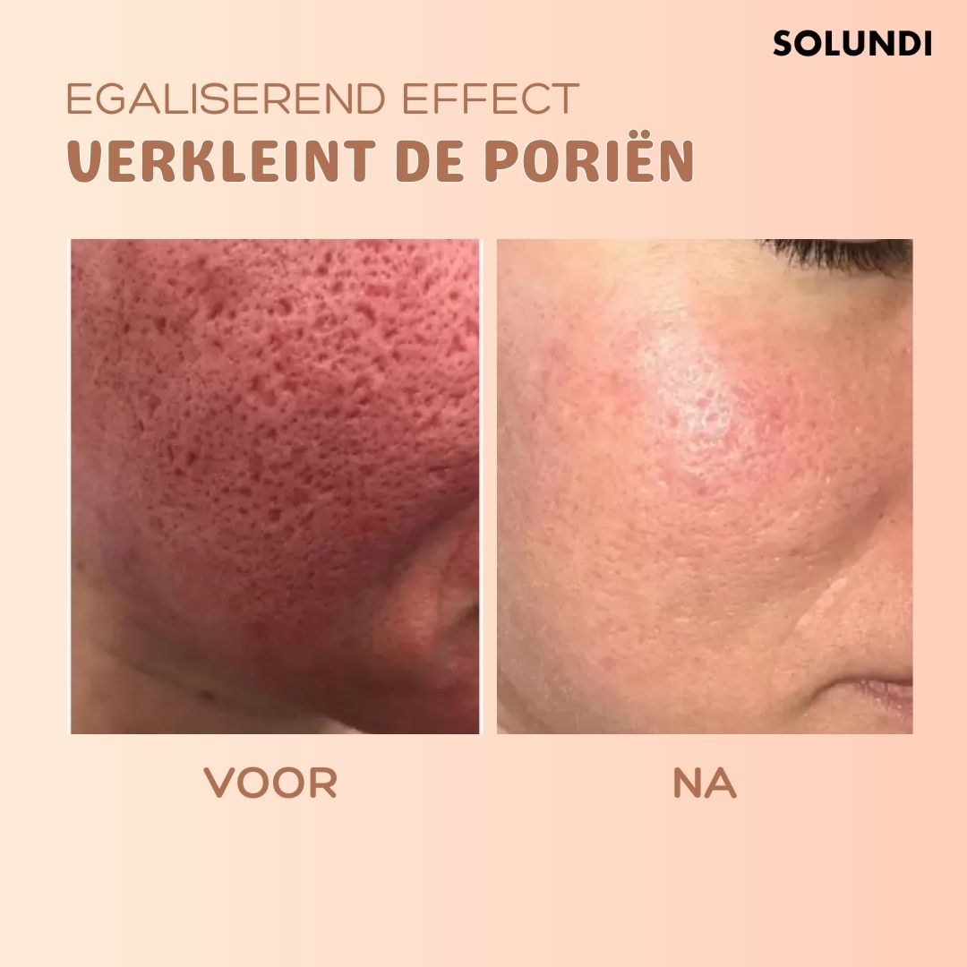 TIJDELIJK 1+1 GRATIS | MultiBalm™ - Anti-rimpel huidvernieuwingsbalsem