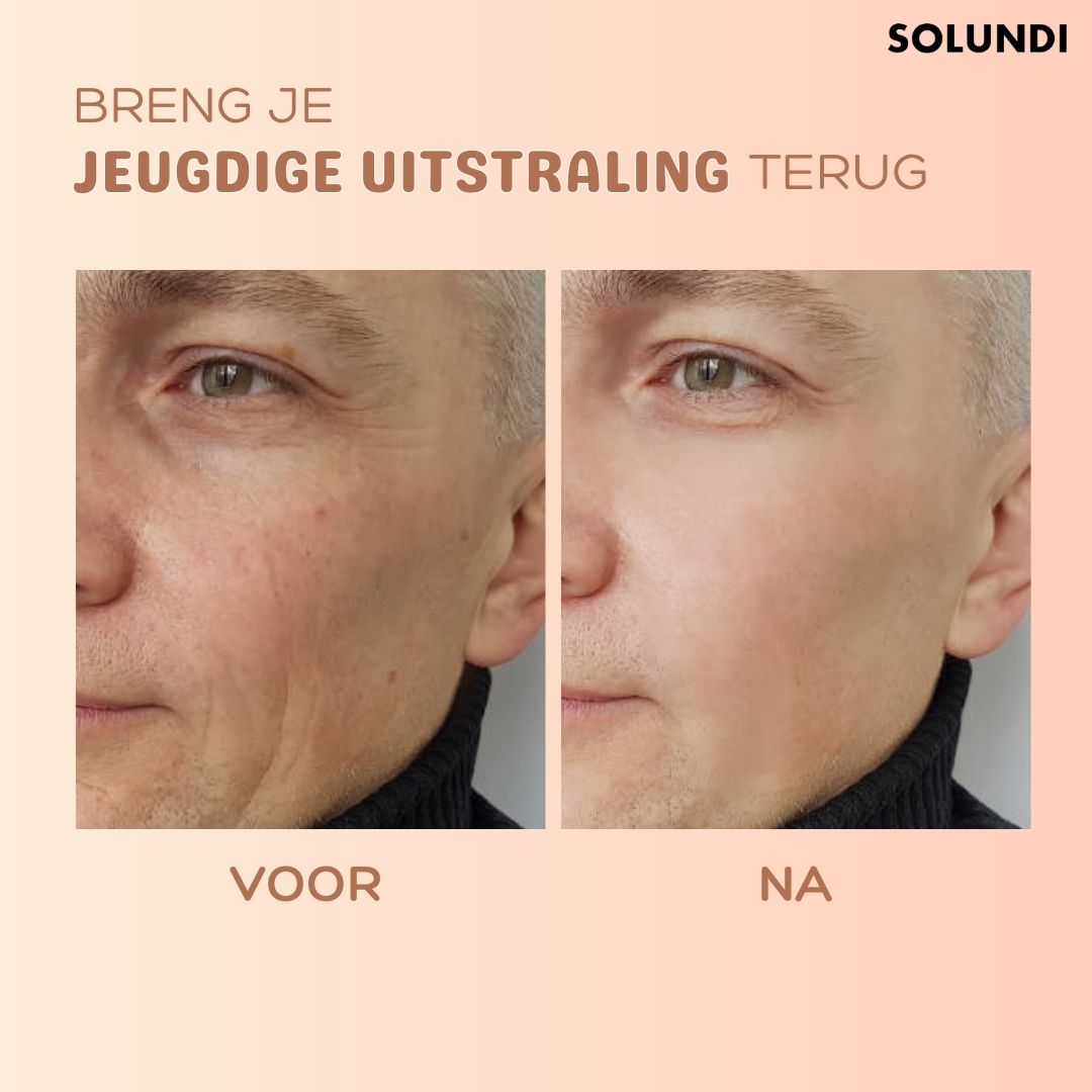 TIJDELIJK 1+1 GRATIS | MultiBalm™ - Anti-rimpel huidvernieuwingsbalsem