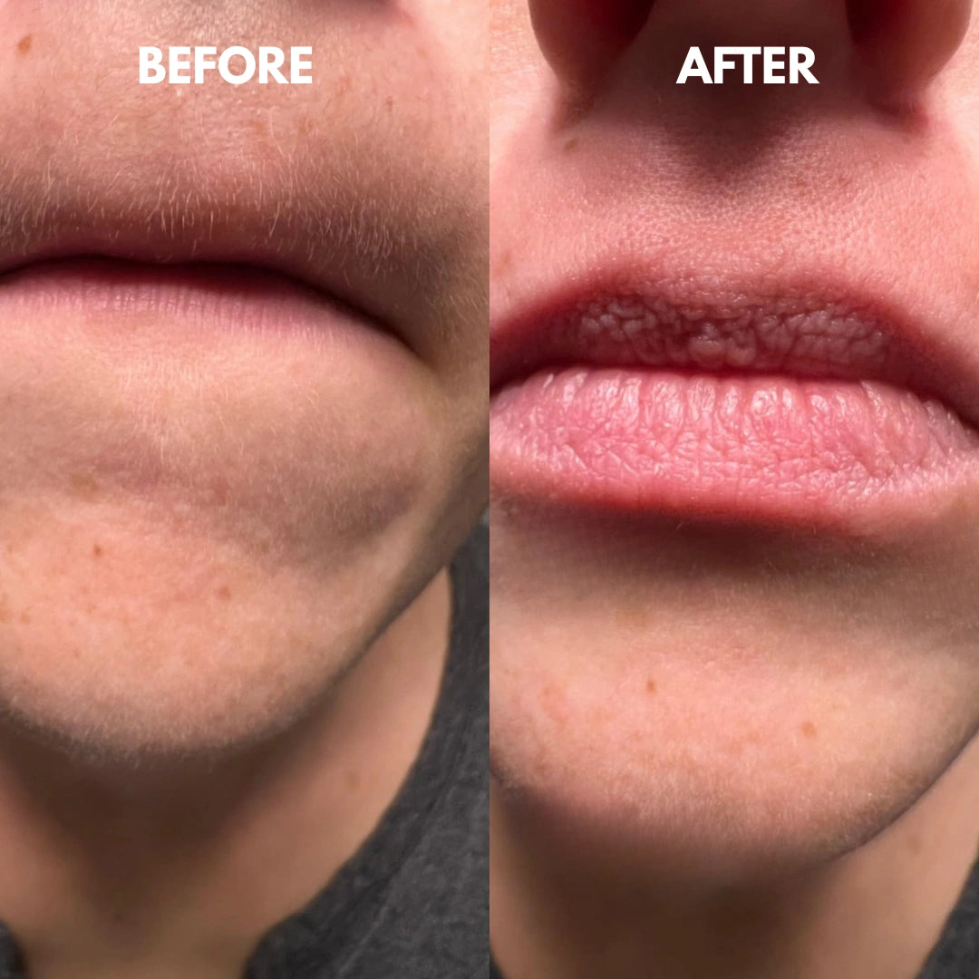 1 + 1 GRATIS VANDAAG | SilkTwist™