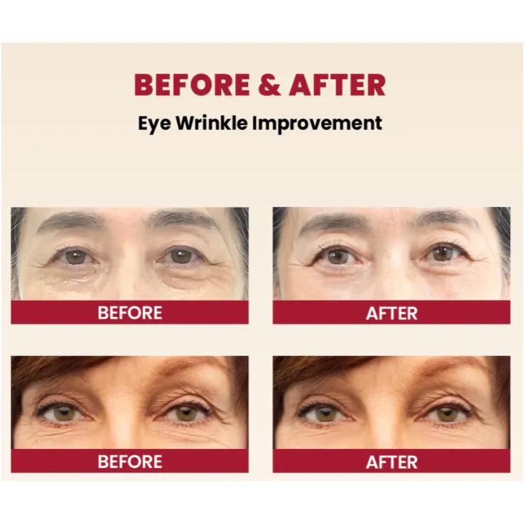 1 + 1 GRATIS VANDAAG | Elixea™