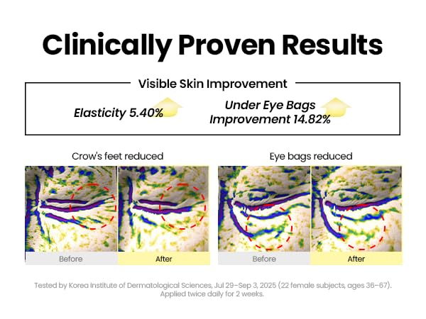 1 + 1 GRATIS VANDAAG | Elixea™