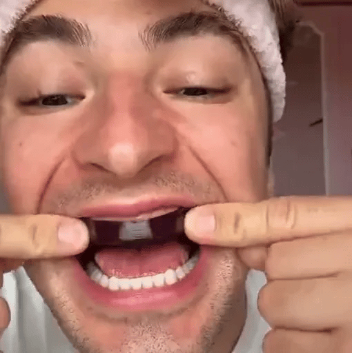 Buencia V34 Whitening Strips