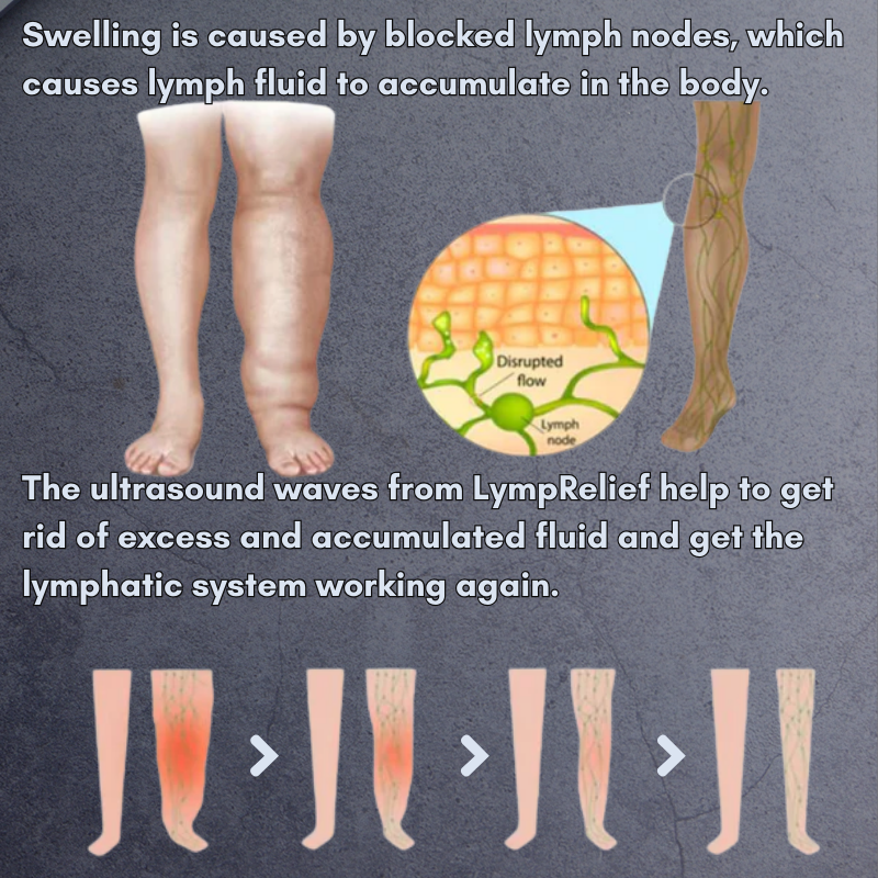 TIJDELIJK 50% KORTING | LymphRelief™