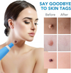 TagErase™ | Verwijder skin tags snel en veilig!
