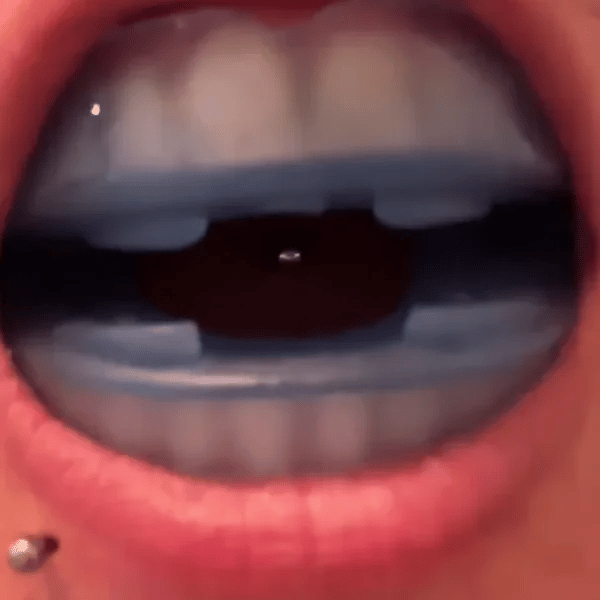 TIJDELIJK 50% KORTING  SnoreAway™