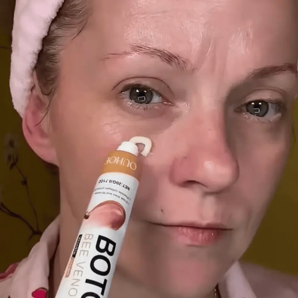 1 + 1 GRATIS VANDAAG  BotoxLux™
