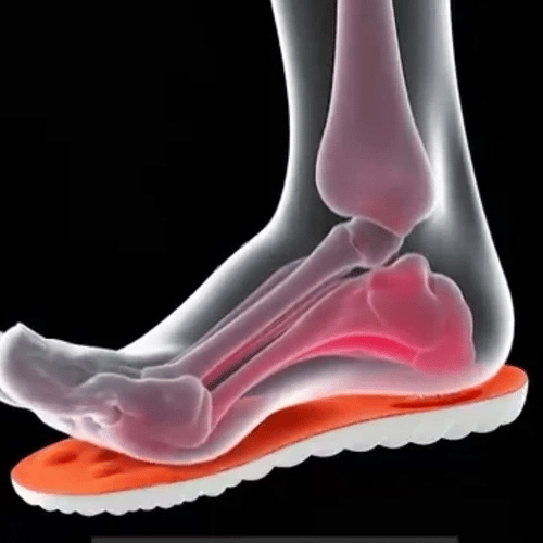 TIJDELIJK 50% KORTING  ReliefStep™ - Verlichtende inlegzolen