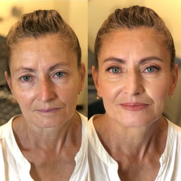 1 + 1 GRATIS VANDAAG  GlowMorph™