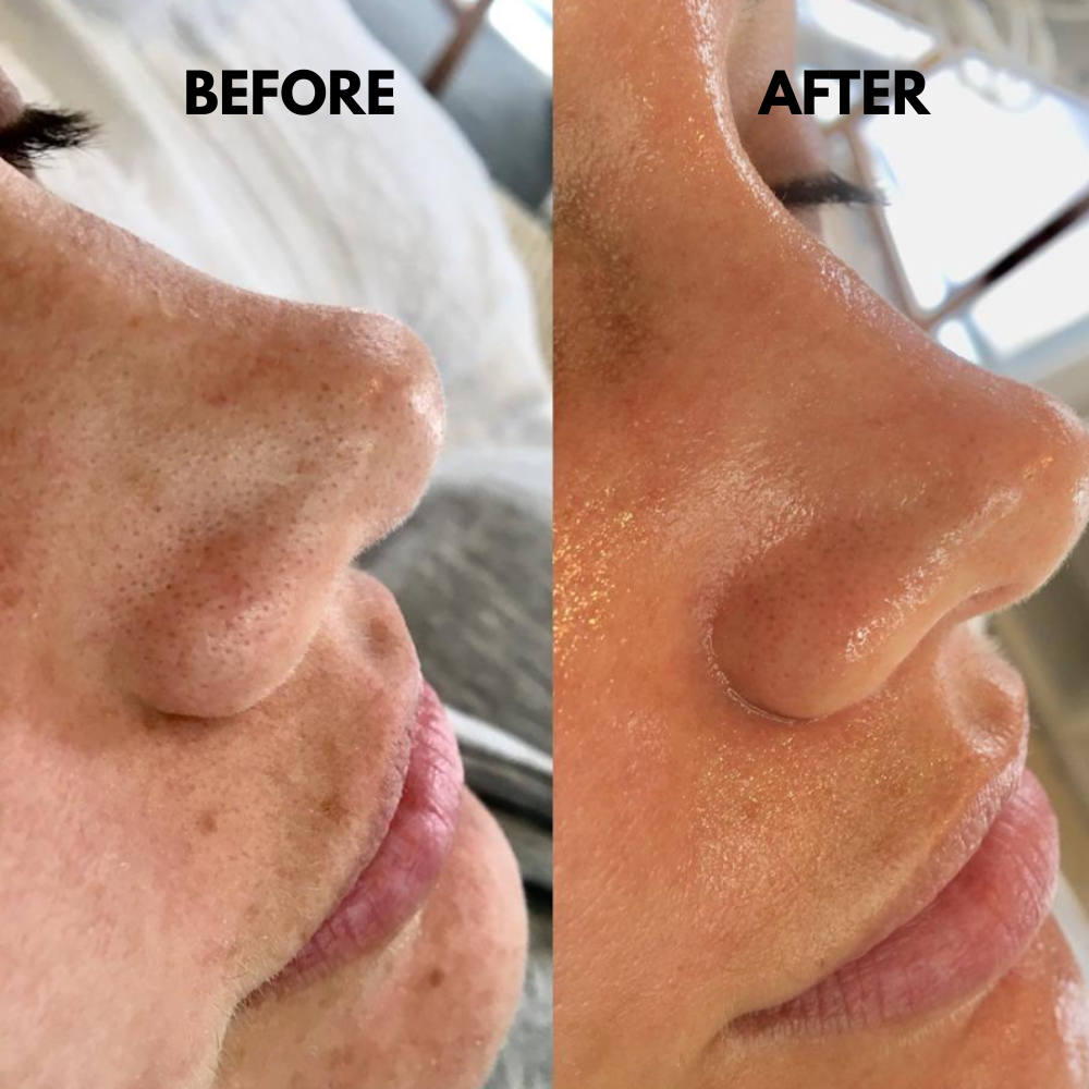 TIJDELIJK 50% KORTING | SkinSonic™