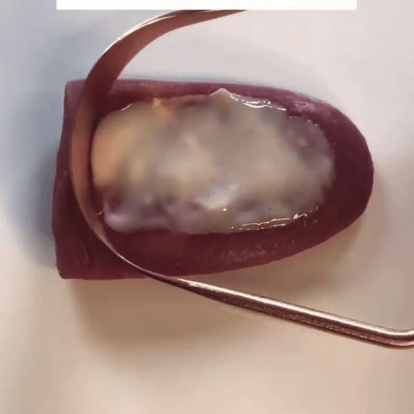 TIJDELIJK 50% KORTING  ScrapeFresh™ - Tongschraper