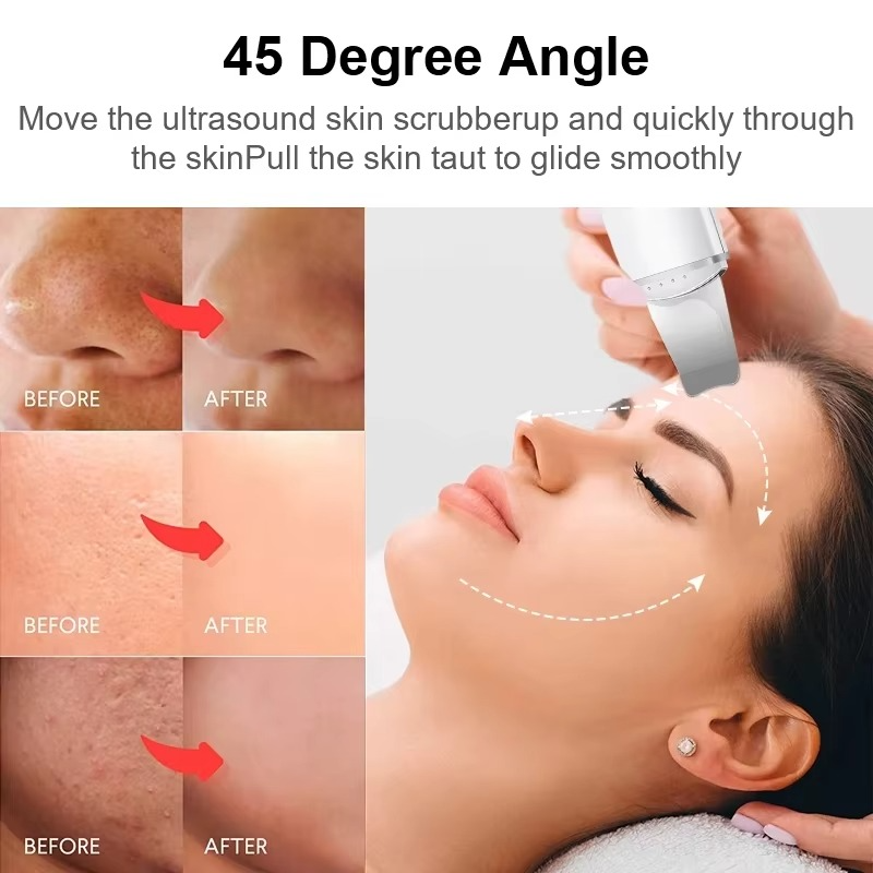 TIJDELIJK 50% KORTING | SkinSonic™