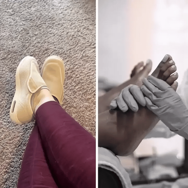 TIJDELIJK 50% KORTING  SoleCura™