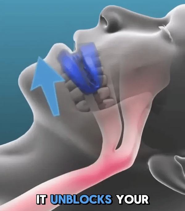 TIJDELIJK 50% KORTING  SnoreAway™