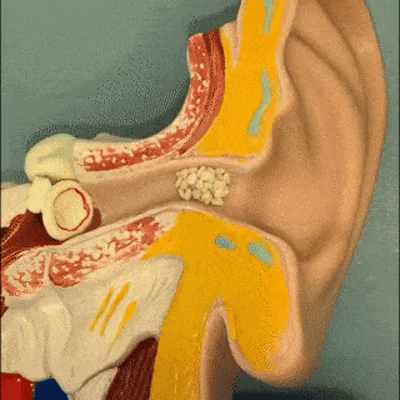 TIJDELIJK 50% KORTING  EarVac™ 