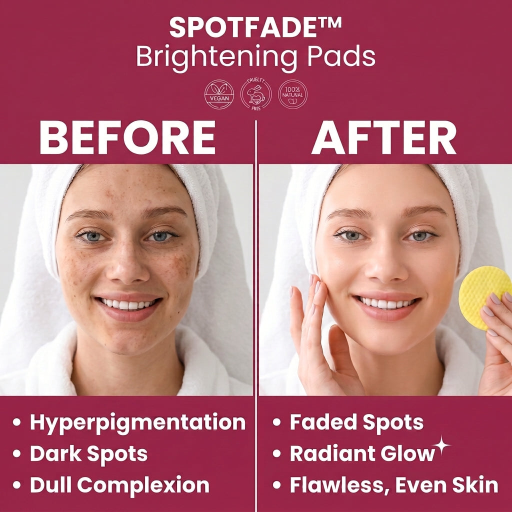 TIJDELIJK 50% KORTING | SpotFade™ - Verhelderende pads