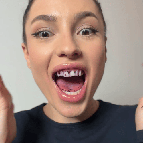 Buencia V34 Whitening Strips