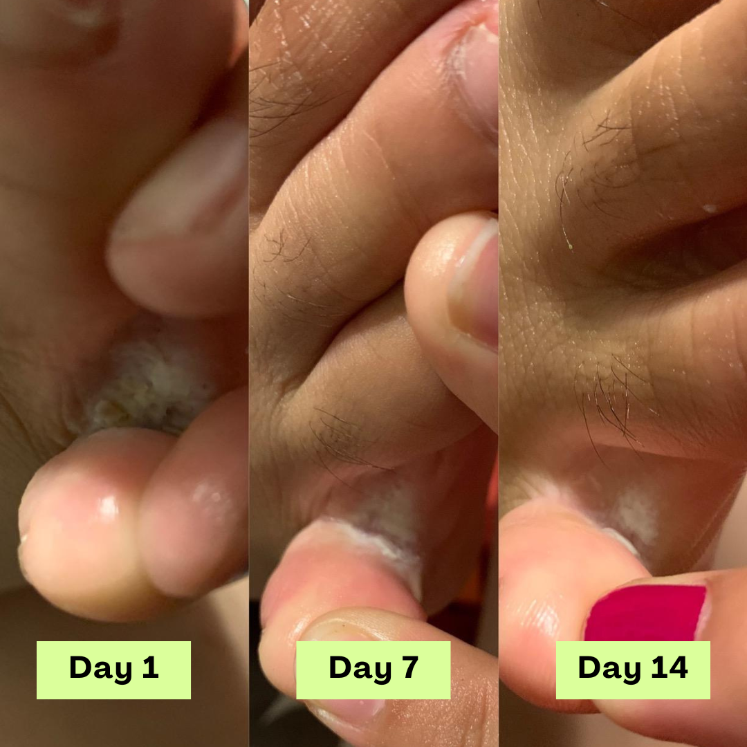 1 + 2 GRATIS VANDAAG | DermaCure™