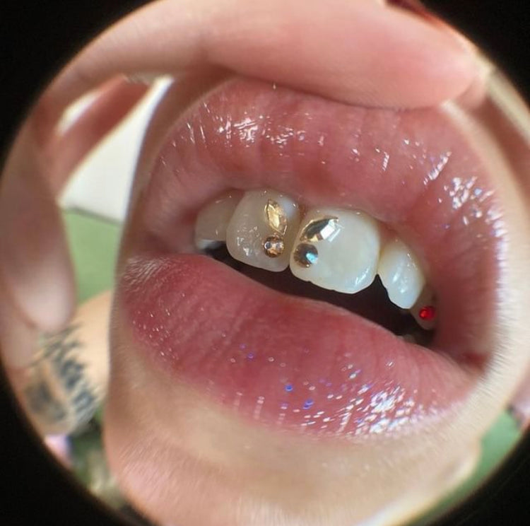 TIJDELIJK 50% KORTING | SmileGems™ - Tandsieraad Set