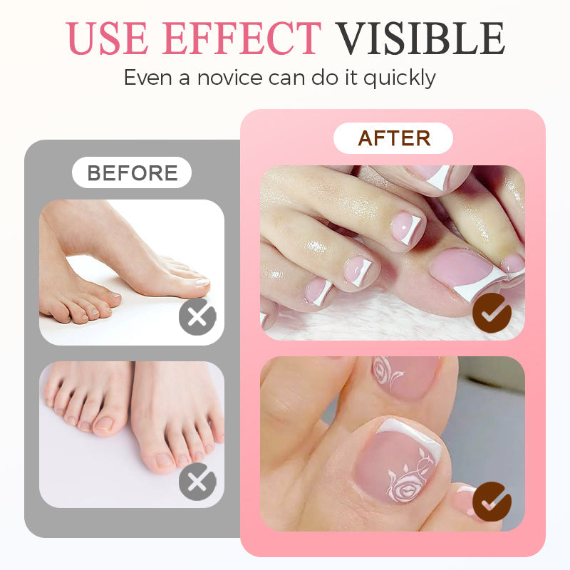 TIJDELIJK 50% KORTING | PressNails™