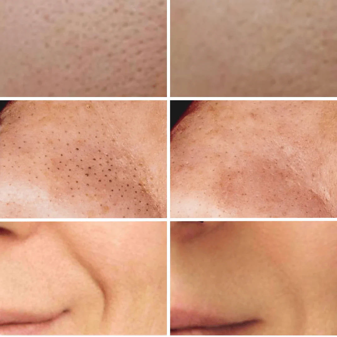 TIJDELIJK 50% KORTING | SkinSonic™