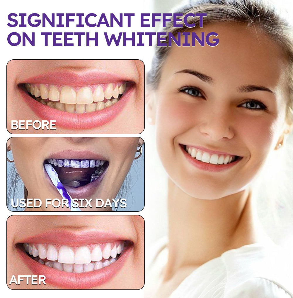 TIJDELIJK 50% KORTING | DentiGlow™