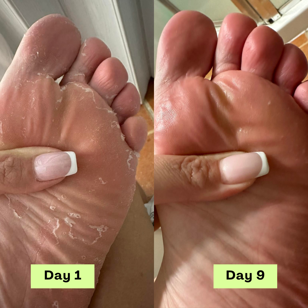 1 + 2 GRATIS VANDAAG | DermaCure™