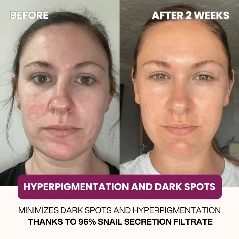 2 + 2 GRATIS VANDAAG | RevitaGlow™
