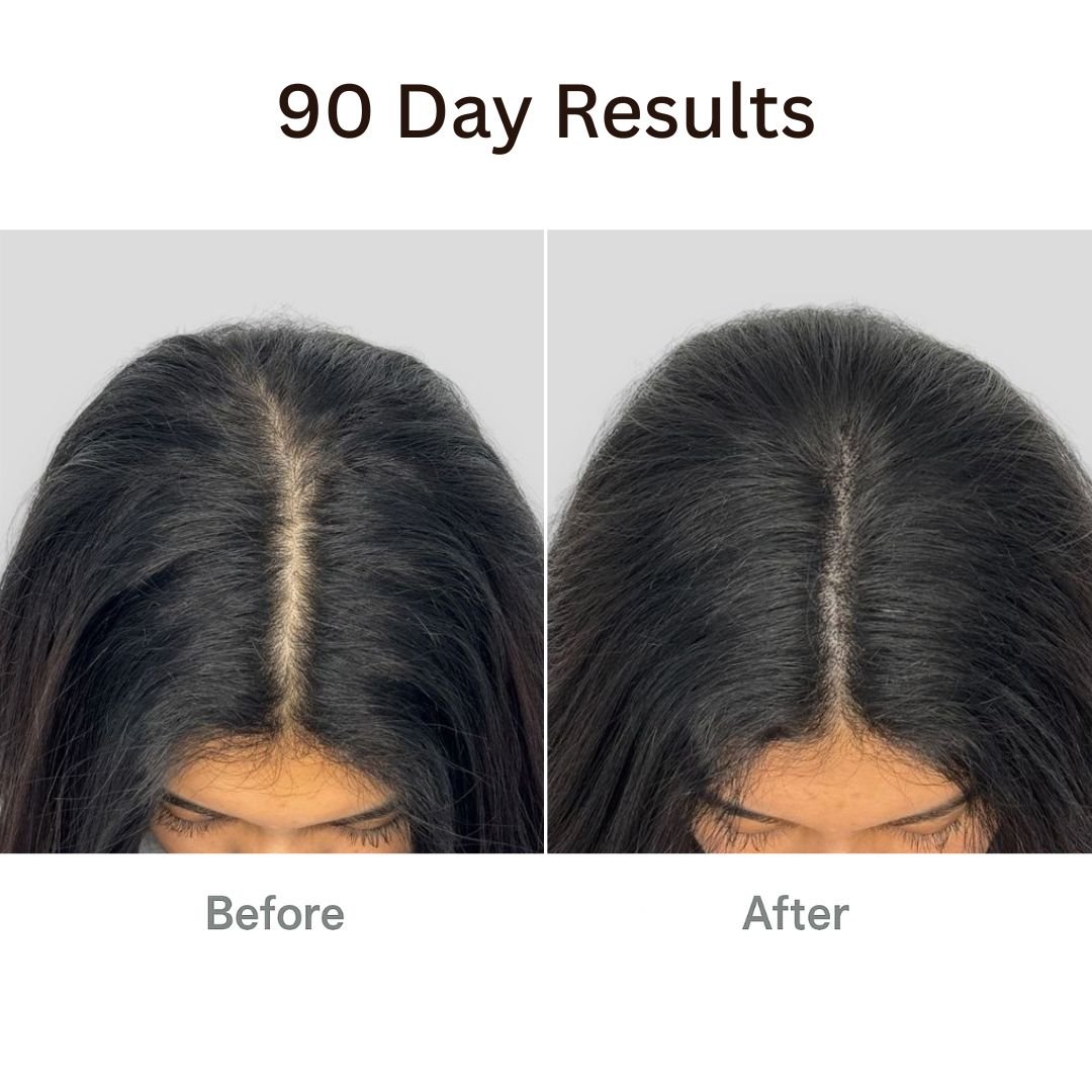 TIJDELIJK 50% KORTING | RevitaBrush™ - 4-in-1 Haarherstelborstel