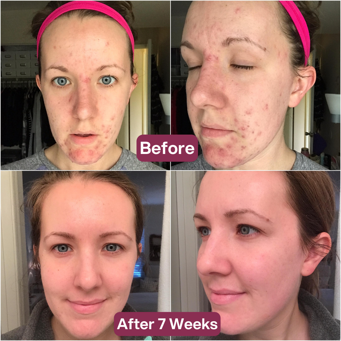 2 + 2 GRATIS VANDAAG | RevitaGlow™