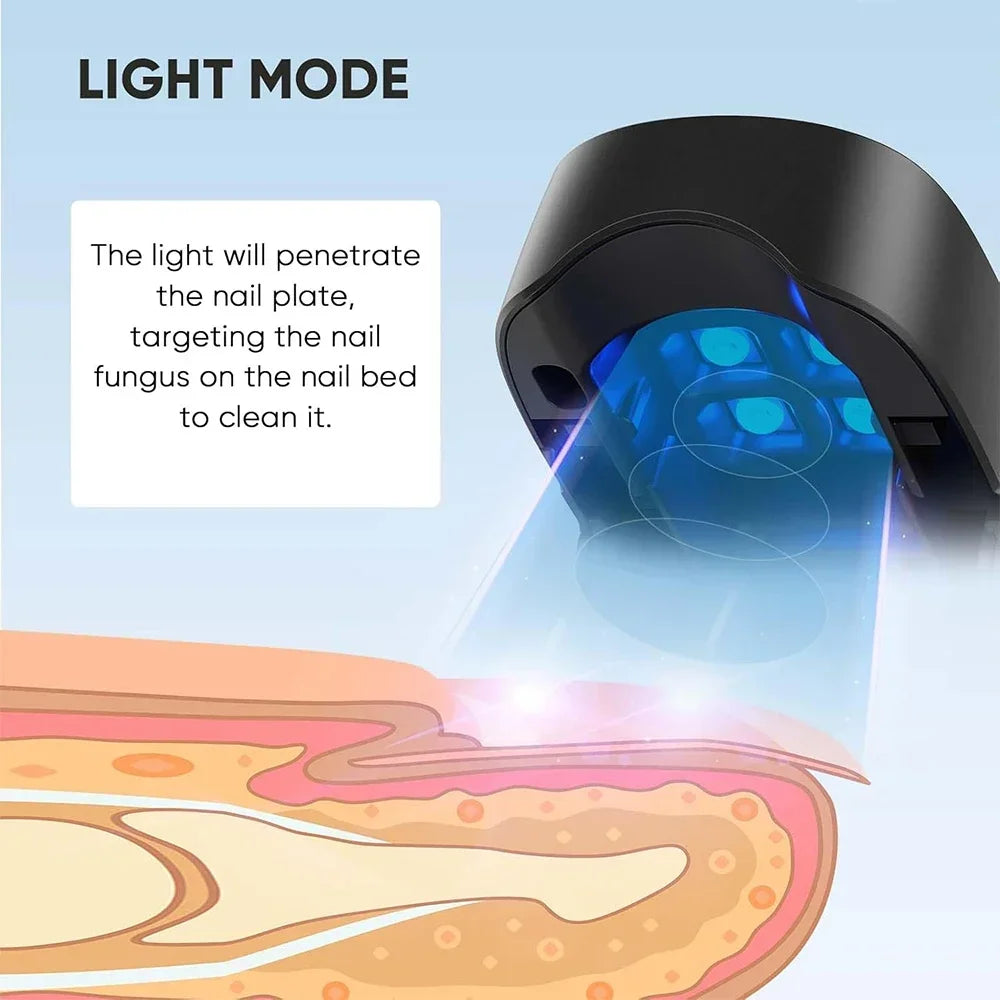 TIJDELIJK 50% KORTING | NailCure™