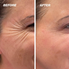 VANDAAG 1 + 1 GRATIS | SkinMend™ | Ervaar een stralende huid!