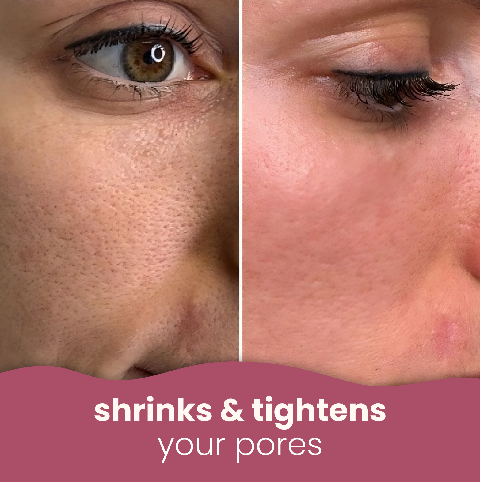 TIJDELIJK 50% KORTING | SpotFade™ - Verhelderende pads