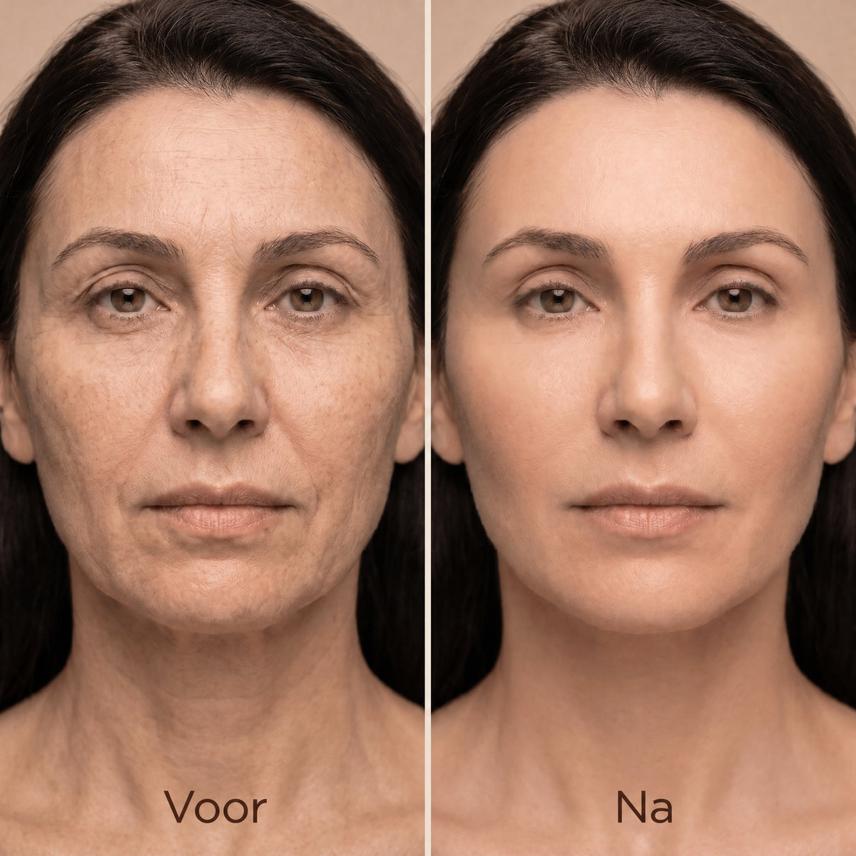 TIJDELIJK 50% KORTING | GlowFirm™ - EMS-gezichtsmassageapparaat