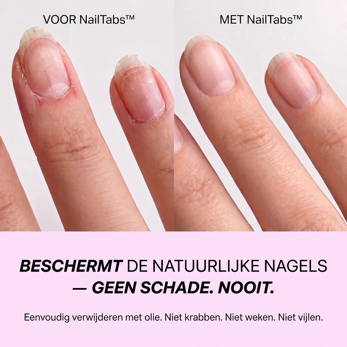 2+2 GRATIS VANDAAG | NailTabs™ - Nagelgelpads