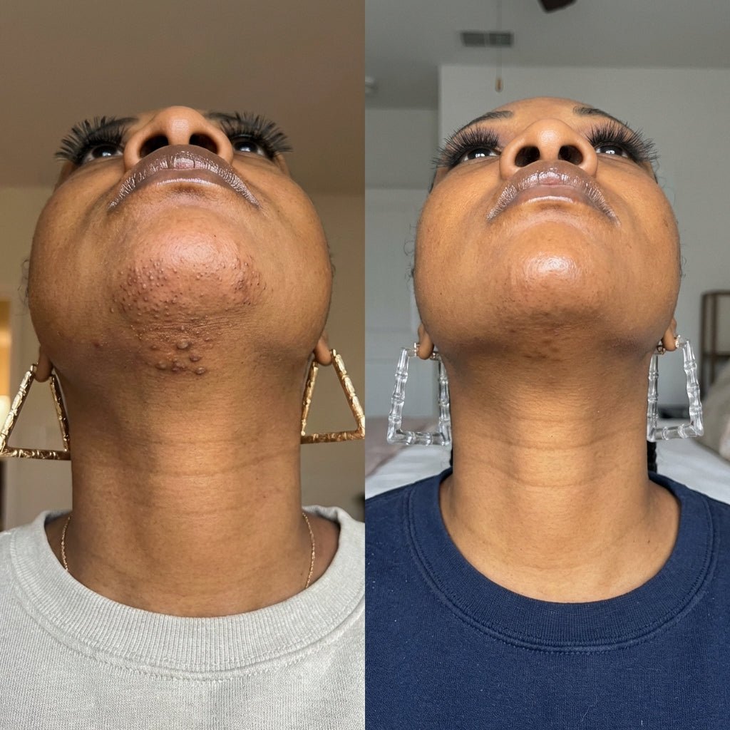 1+1 GRATIS VANDAAG | Virelle™ - Huidserum