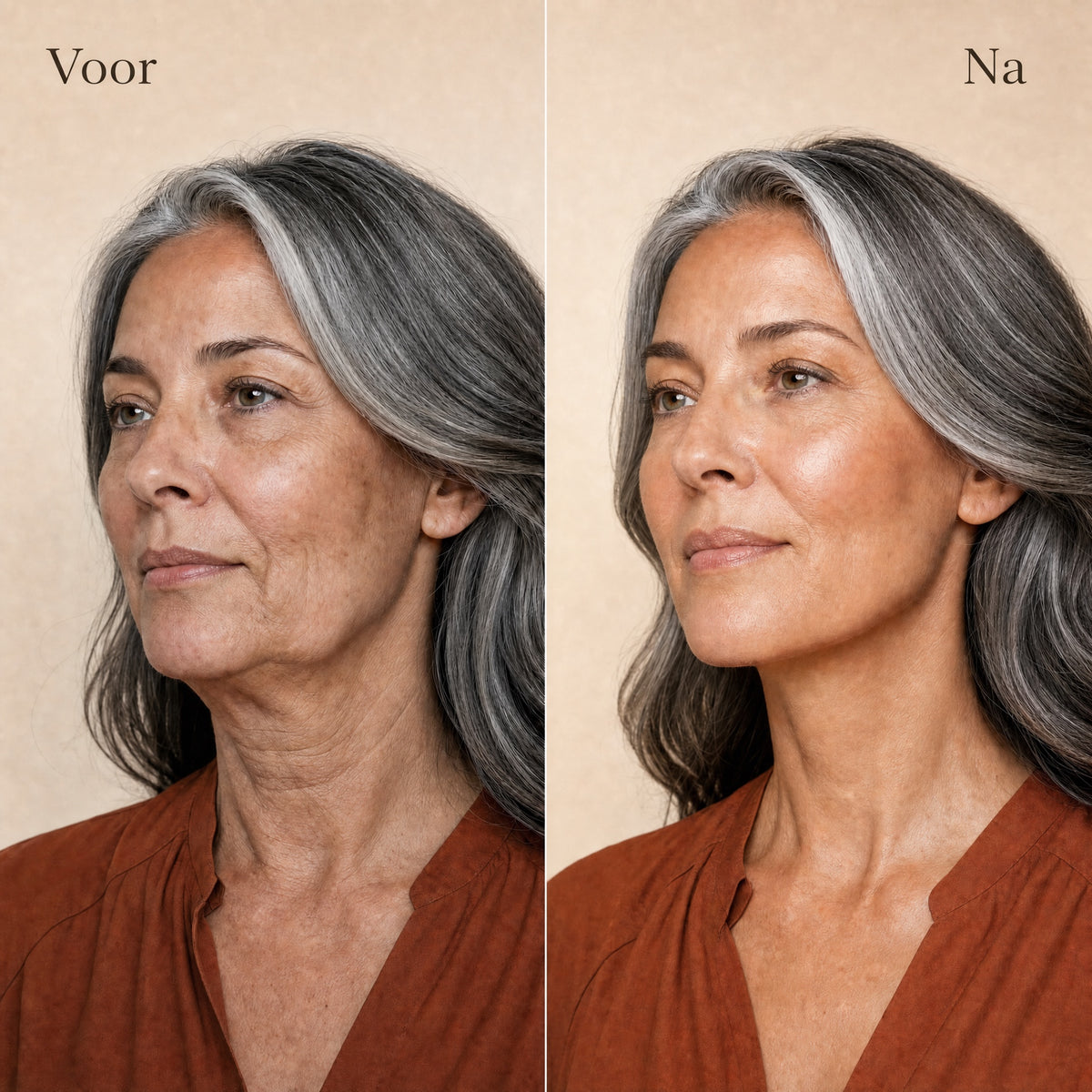 TIJDELIJK 50% KORTING | GlowFirm™ - EMS-gezichtsmassageapparaat