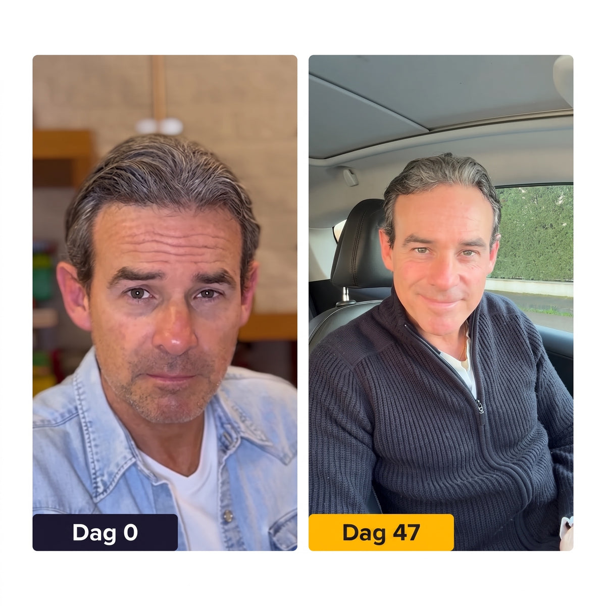 TIJDELIJK 50% KORTING | PrimeSkin™ - Anti-aging nachtcrème