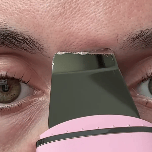 TIJDELIJK 50% KORTING  SkinSonic™