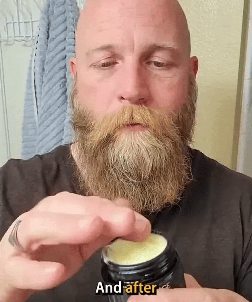 1+1 GRATIS VANDAAG  ForgeDerm™ - Talgbalsem