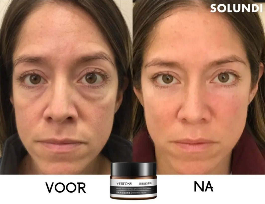 EyeRejuv™- Verbluffende oogcrème!