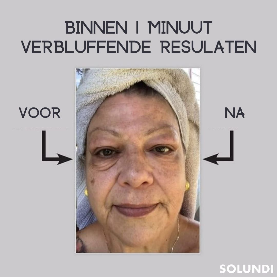 EyeRejuv™- Verbluffende oogcrème!